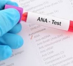 تست ANA