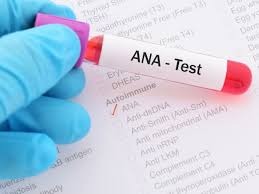 تست ANA